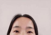 哮喘真的是“不治之症”？她的经历告诉你并非如此