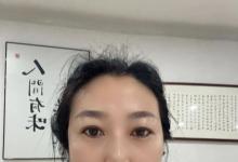 2000元挂号费的专家治不好的皮肤病，是什么力量让他痊愈的？