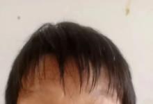 一人服用到三代收益，这里面都经历了什么？