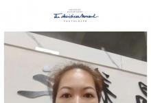 不用打针吃药，娃湿疹好了吃饭也变香了。